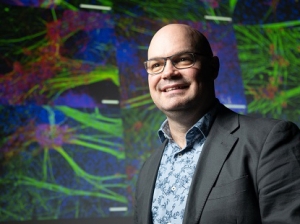 World-class brain research boost