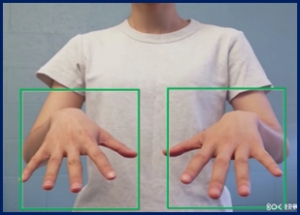 Hand test