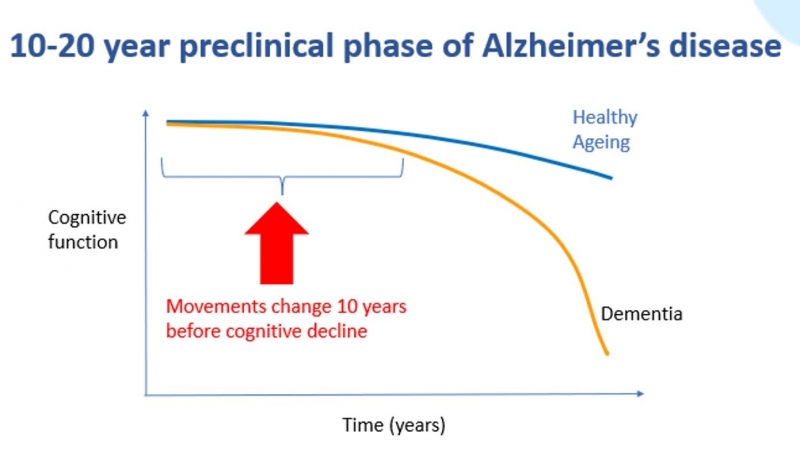 Chart: 10-12 year preclinical phase of Alzheimer's disease